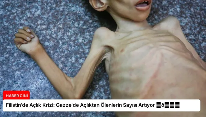 Filistin’de Açlık Krizi: Gazze’de Açlıktan Ölenlerin Sayısı Artıyor ⏬👇